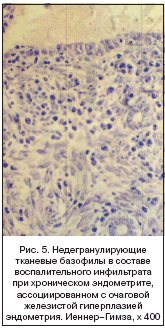 Рис. 5. Недегранулирующие тканевые базофилы в составе воспалительного инфильтрата при хроническом эндометрите, ассоциированном с очаговой железистой гиперплазией эндометрия. Иеннер–Гимза, x 400
