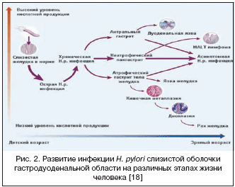 Рис. 2. Развитие инфекции Н. pylori слизистой оболочки гастродуоденальной области на различных этапах жизни человека [18]