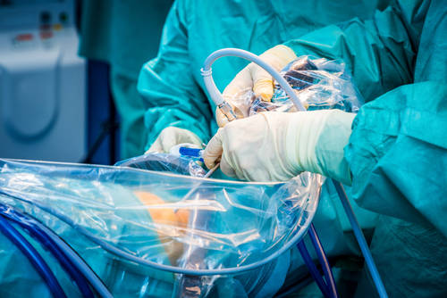 Современные принципы снижения периоперационных кардиальных осложнений при внесердечных хирургических вмешательствах