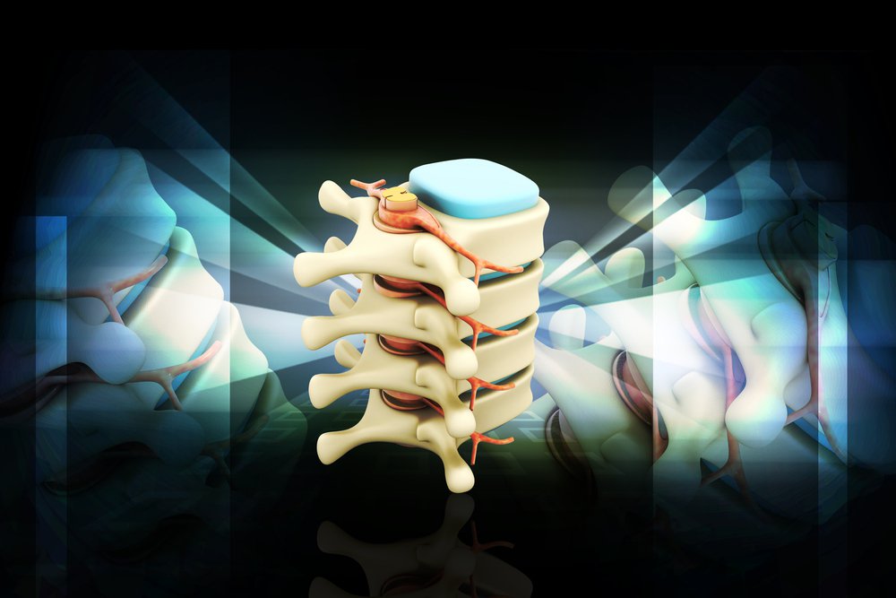Пациент с болью в спине: что сокрыто под диагнозом «остеохондроз»