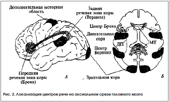 Рис. 2. Локализация центров речи на аксиальном срезе головного мозга