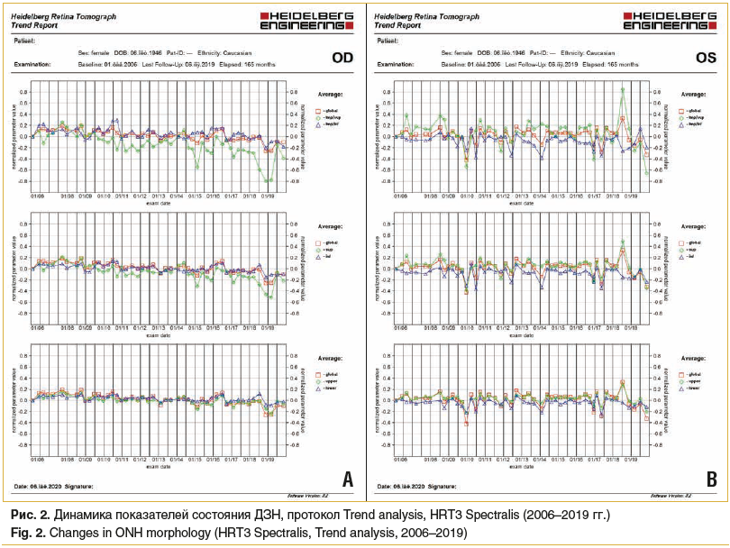 Рис. 2. Динамика показателей состояния ДЗН, протокол Trend analysis, HRT3 Spectralis (2006–2019 гг.) Fig. 2. Changes in ONH morphology (HRT3 Spectralis, Trend analysis, 2006–2019)