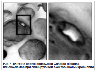 Рис. 1. Влияние сертаконазола на Candida albicans, наблюдаемое при сканирующей электронной микроскопии