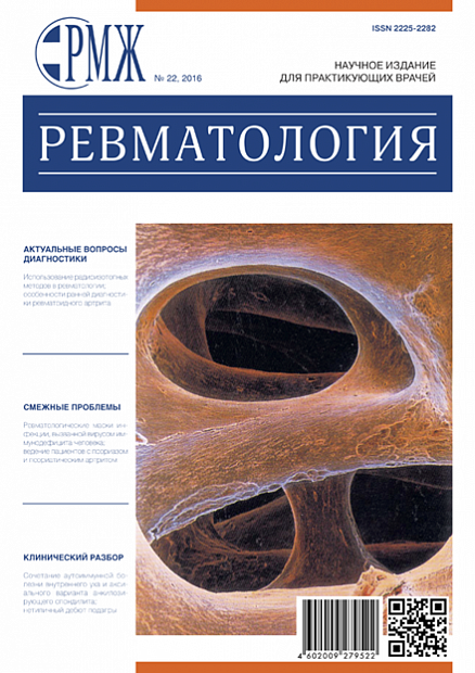 Ревматология № 22 - 2016 год | РМЖ - Русский медицинский журнал