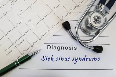 Диагностика и лечение синдрома слабости синусового узла