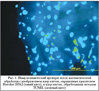 Рис. 1. Иммунохимический препарат после математической обработки с изображением ядер клеток, окрашенных красителем Hoechst 33342 (синий цвет), и ядер клеток, обработанных методом TUNEL (зеленый цвет)
