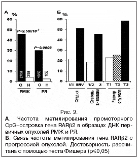 Рис. 3. А. Частота метилирования промоторного CpG–островка гена RARβ2 в образцах ДНК пер- вичных опухолей РМЖ и РЯ. Б. Связь частоты метилирования гена RARβ2 с прогрессией опухолей. Достоверность рассчи- тана с помощью теста Фишера (p≤0,05)