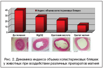 Рис. 2. Динамика индекса объёма холестериновых бляшек у животных при воздействии различных препаратов магния