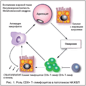 Рис. 1. Роль CD8+ T–лимфоцитов в патогенезе НАЖБП