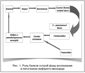 Рис. 1. Роль белков острой фазы воспаления в патогенезе инфаркта миокарда