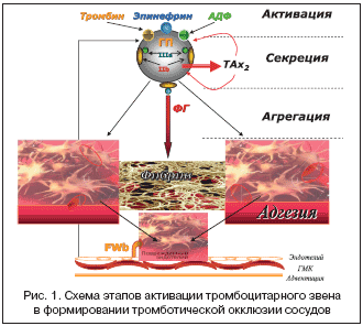 Рис. 1. Схема этапов активации тромбоцитарного звена в формировании тромботической окклюзии сосудов