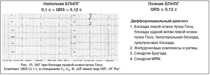 Диагностика нарушений проводимости сердца (часть 2) | Ялымов А.А ...