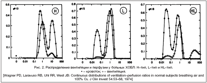 Рис. 2. Распределение вентиляции и перфузии у больных ХОБЛ: Н–тип, L–тип и HL–тип.