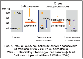 Рис. 4. PaO2 и PaСO2 при болезнях легких в зависимости от отношения V/Q и минутной вентиляции.