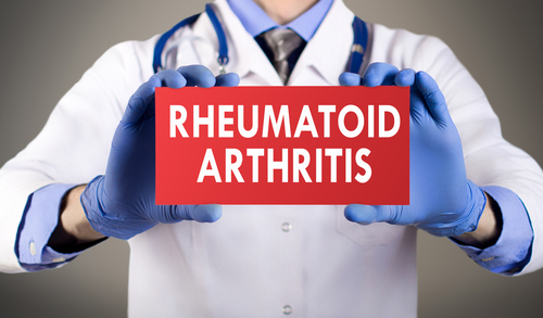 Ревматоидный артрит: роль врача общей практики в улучшении исходов заболевания