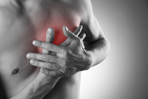 Инфаркт миокарда у молодого мужчины со специфическими факторами риска ишемической болезни сердца, длительно занимавшегося бодибилдингом