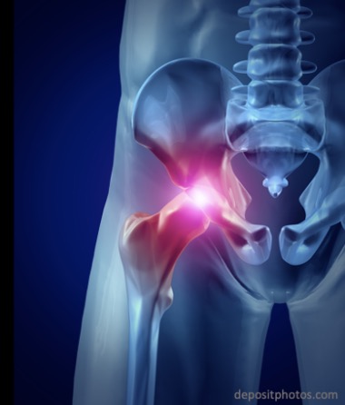 Американская академия хирургов-ортопедов обновила рекомендации по ведению пожилых пациентов с переломами бедренной кости