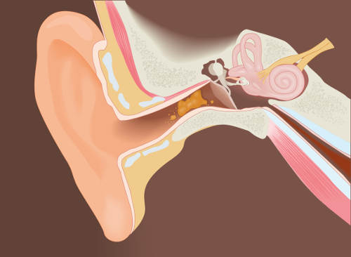 Ушная сера: актуальные вопросы нормы и патологии в клинической практике