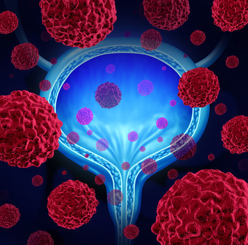 Современные вопросы молекулярной диагностики рака мочевого пузыря