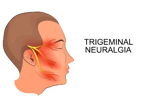 Тригеминальные боли: топическая диагностика, клинические проявления