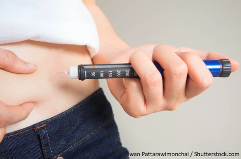 Инсулинотерапия при сахарном диабете 2 типа у пациентов с морбидным ожирением: факторы эффективной компенсации нарушений углеводного обмена