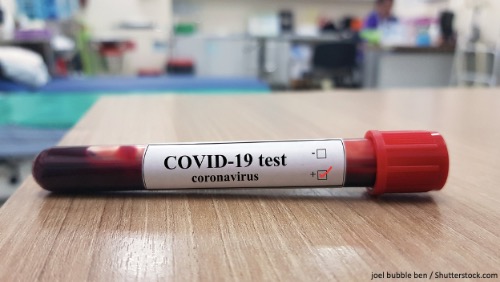 Клинико-лабораторная характеристика COVID-19