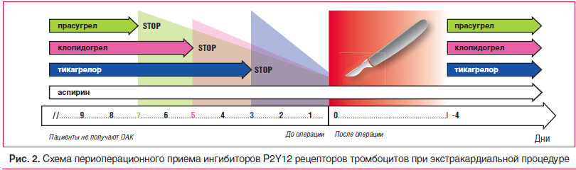 Рис. 2. Схема периоперационного приема ингибиторов P2Y12 рецепторов тромбоцитов при экстракардиальной процедуре