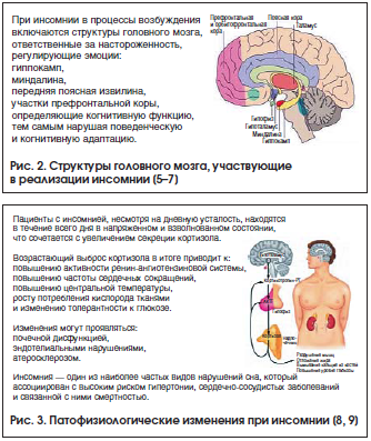 Рис. 2. Структуры головного мозга, участвующие в реализации инсомнии [5–7]