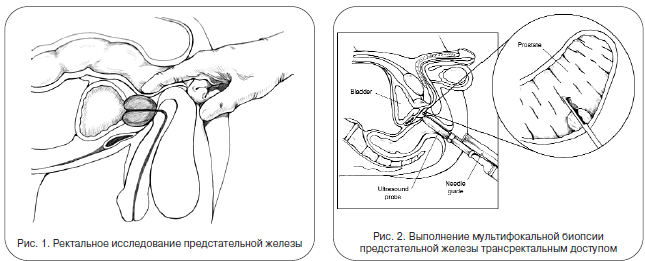 Структура предстательной железы