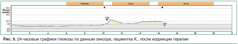 Рис. 9. 24-часовые графики глюкозы по данным сенсора, пациентка К., после коррекции терапии