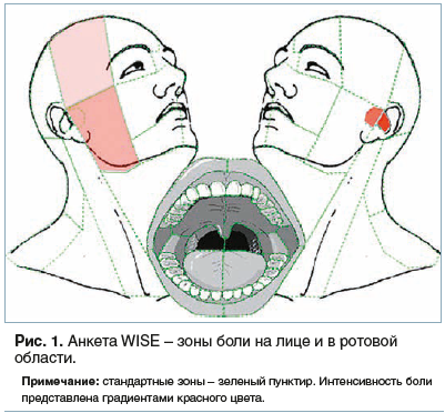 Рис. 1. Анкета WISE – зоны боли на лице и в ротовой области.