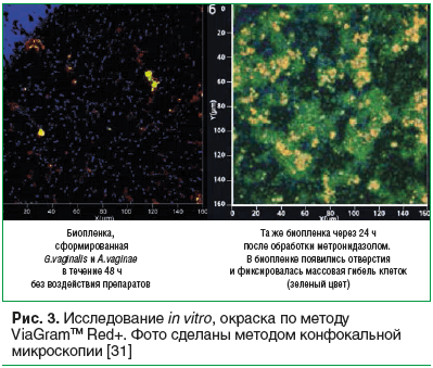 Рис. 3. Исследование in vitro, окраска по методу ViaGramTM Red+. Фото сделаны методом конфокальной микроскопии [31]