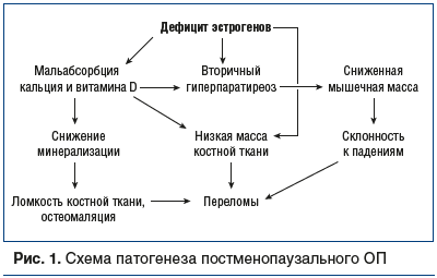 Рис. 1. Схема патогенеза постменопаузального ОП