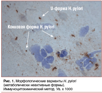 Рис. 1. Морфологические варианты H. pylori (метаболически неактивные формы). Иммуноцитохимический метод. Ув. х 1000