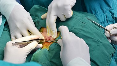 Опыт хирургического лечения врожденных аномалий развития уха, сочетанных с врожденной холестеатомой височной кости: клинические наблюдения