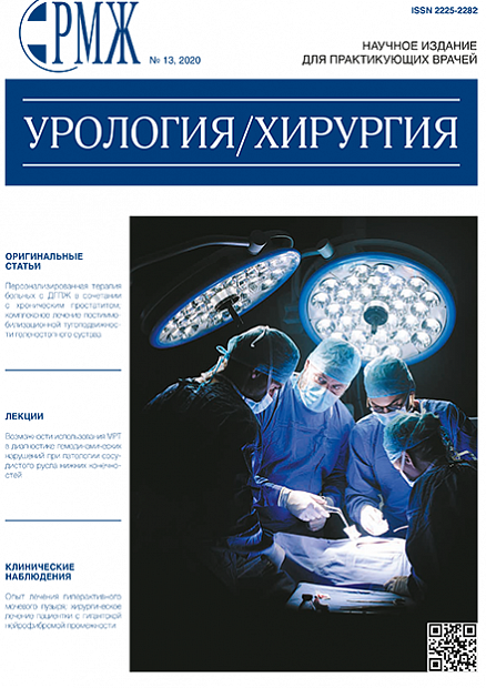 Урология. Хирургия № 13 - 2020 год | РМЖ - Русский медицинский журнал