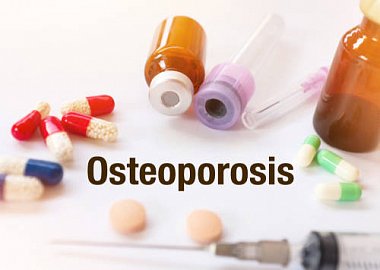 Принципы ведения пациентов с глюкокортикоидным остеопорозом